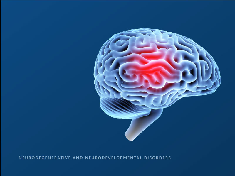 Neurological illustration